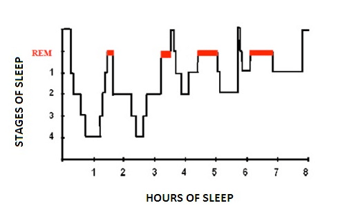 Sleep-wake disorders: definition, contexts and neural correlations ...