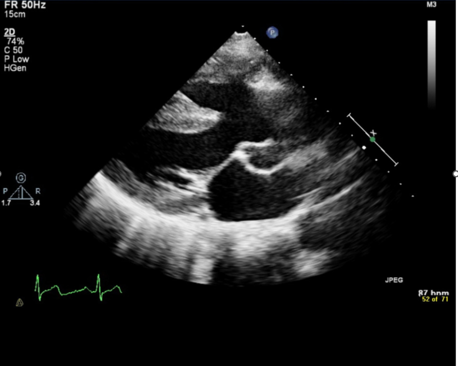 A close-up of an ultrasound

AI-generated content may be incorrect.