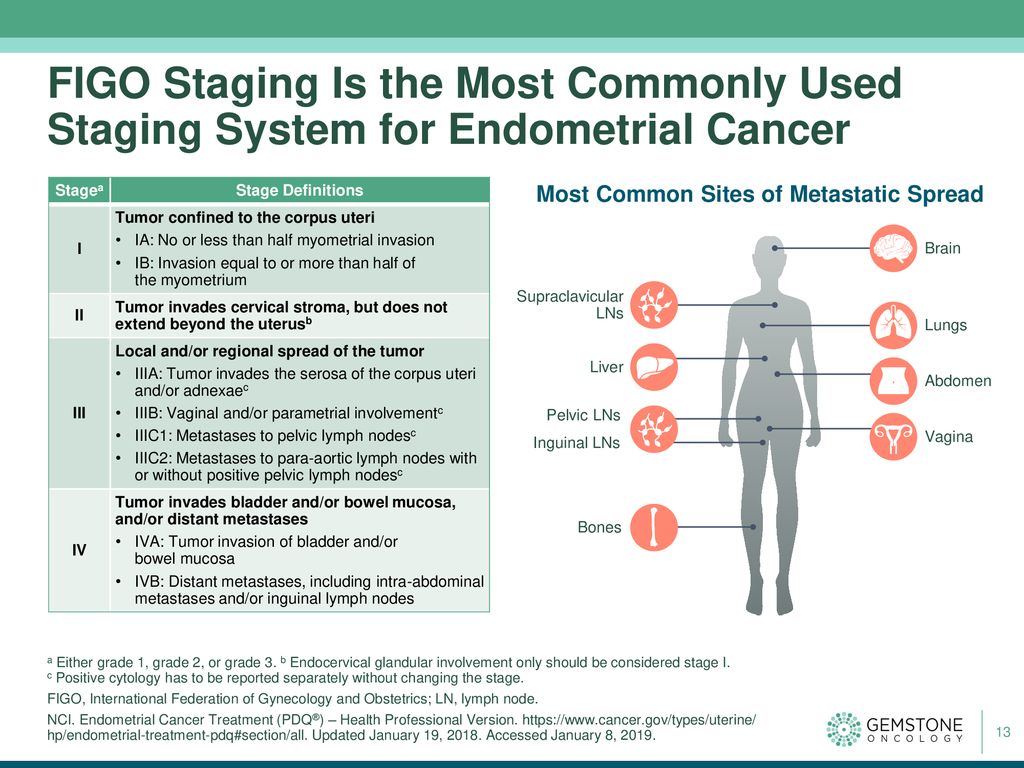 Sentinel Node In Endometrial Cancer Metastatic Pathways Auctores