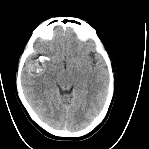 A close-up of a brain scan

AI-generated content may be incorrect.