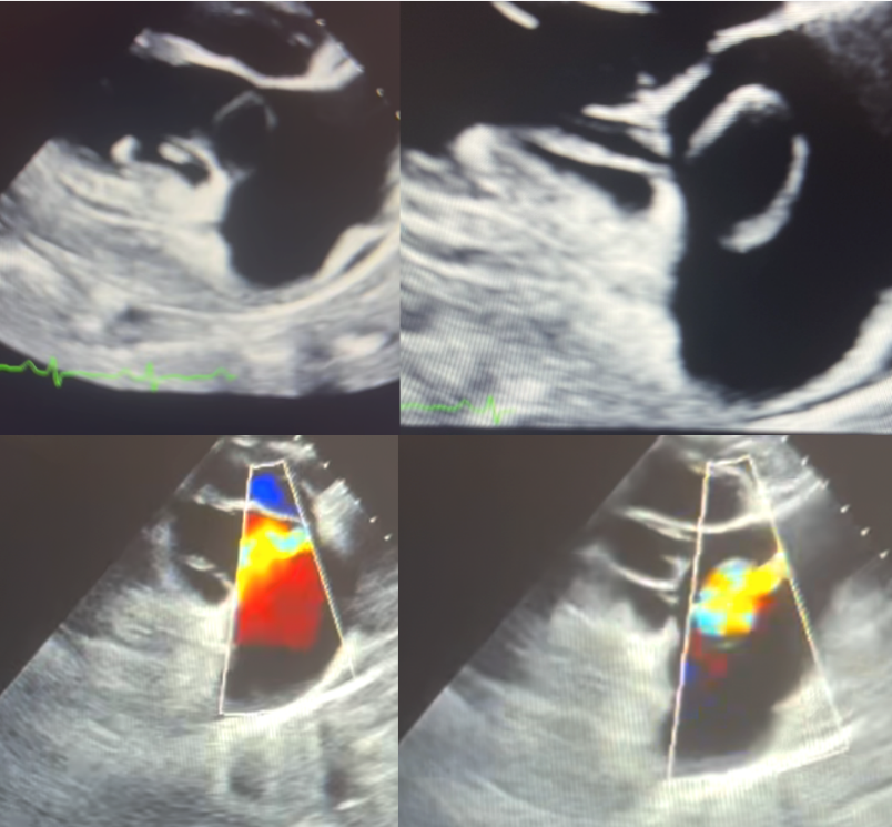 A collage of ultrasound images

AI-generated content may be incorrect.