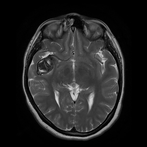 A close-up of a brain scan

AI-generated content may be incorrect.