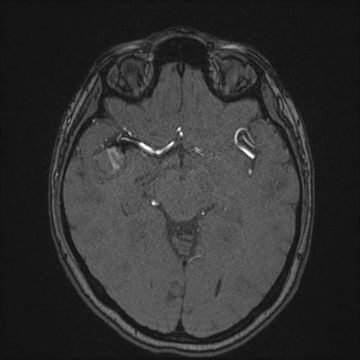 A close-up of a brain scan

AI-generated content may be incorrect.