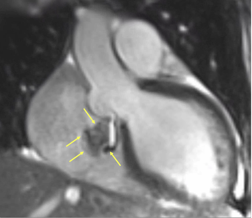 A close-up of a fetus

AI-generated content may be incorrect.